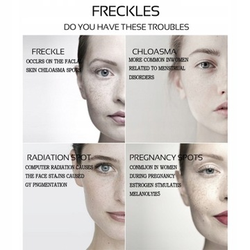 Skuteczne Usuwanie Piegów Krem Do Wybielania