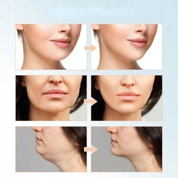 ЭЛЕКТРИЧЕСКИЙ МАССАЖЕР ДЛЯ ЛИЦА V-FACE LIFTING