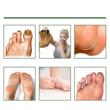 НОСКИ С ОТшелушивающей МАСКОЙ ДЛЯ НОГ 1 ПАРА УВЛАЖНЯЮТ И УДАЛЯЮТ ЗАПАХИ