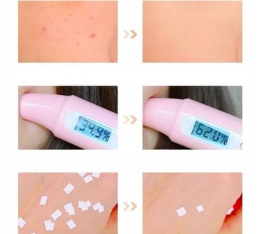 trójkolorowa paleta korektora obejmująca trądzik i cienie