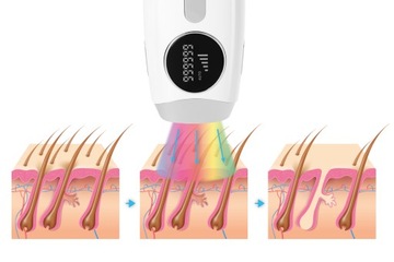 Эпилятор Krexus Body Bikini PRO IPL 5 режимов