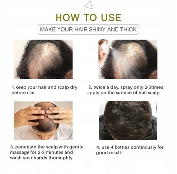 Спрей против выпадения волос «Имбирь» для роста волос