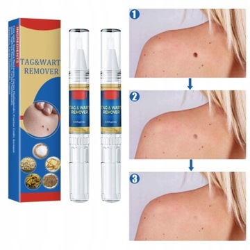 2SZT Pióro Środek do usuwania kurzajek 3ML