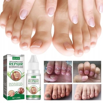 Грибок ногтей Strong Nail Repair Liquid 20 мл