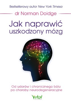 Jak naprawić uszkodzony mózg. - ebook