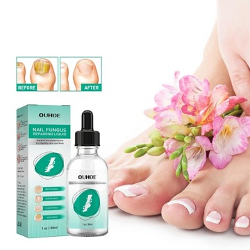 Эссенция для восстановления ногтей Лечение грибка ногтей