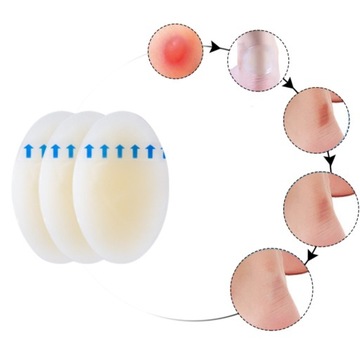 ГИДРОКОЛОЛИДНЫЕ ПЛАСТКИ ОТ МЫСЛИ, Ссадины, ОТПЕЧАТКИ