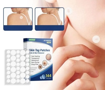 Пластырь для удаления бородавок, пластырь для удаления кожных меток, пластырь от прыщей (144 шт.), 2 шт.