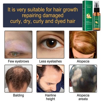 Новый спрей для роста волос Grow Fast Oil