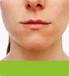 6x Derminax ОТ АКНЕ, ШРАВОВ, ГЛАДКАЯ КОЖА