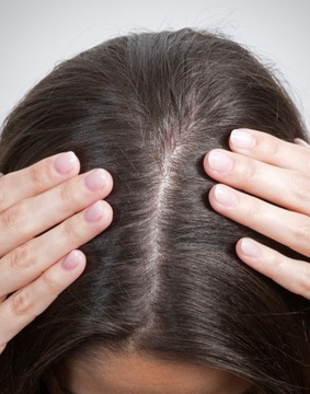 Ampułki na wypadanie włosów Seboradin FORTE 7 x 5,5 ml