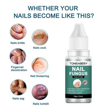 10 мл. Капли для ухода за ногами от грибка ногтей на ногах.
