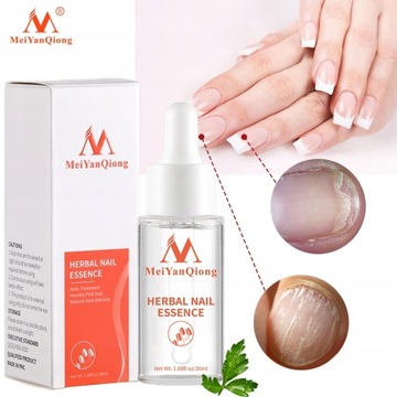 Grzybica Paznokci Pielęgnacja Stóp Essence Nail