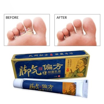 Fungus Removal Foot Cream Nail Fungus Removal Cream Anti-itching Foot Cream