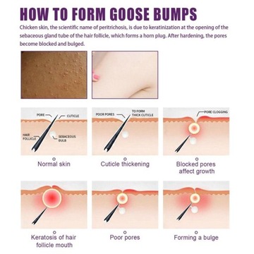 Отшелушивающий отбеливатель осветляет тусклую кожу