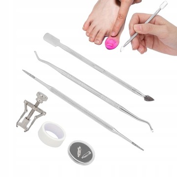 КОРРЕКЦИЯ ВРАСТНЫХ НОГТЕЙ НОСИНЫЕ