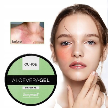 АЛОЭ УСПОКАИВАЮЩИЙ ГЕЛЬ - АЛОЭ ГЕЛЬ 50г