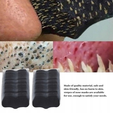 ПАТЧИ ОТ ЧЕРНЫХ ГОЛОВ, угрей на носу - 100 шт.