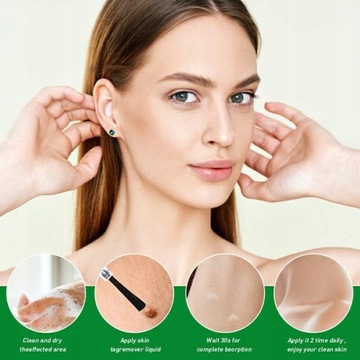 10 мл жидкость для лечения бородавок на теле, жидкость для удаления бородавок, анти