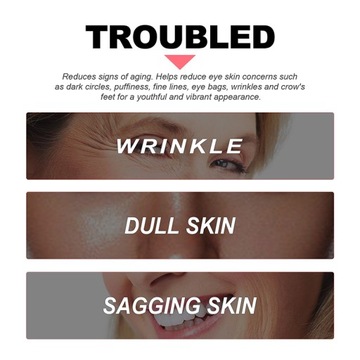 Крем для глаз с ретинолом против морщин, убирает мешки под глазами