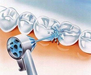 ПРОФЕССИОНАЛЬНАЯ ИРРИГАЦИЯ ЗУБОВ Oral-B OxyJet