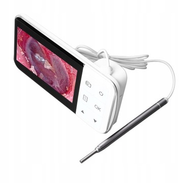 Цифровой отоскоп Визуальный удобный ушной вкладыш