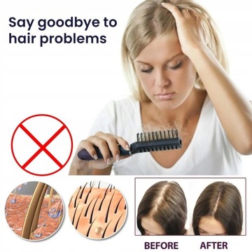 Спрей для роста волос Спрей для роста волос