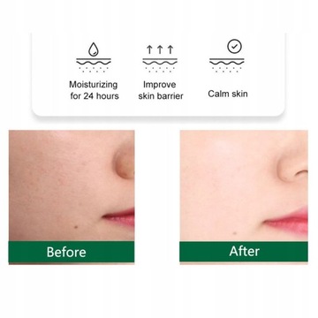 УВЛАЖНЯЮЩИЙ КРЕМ С САЛИЦИЛОВОЙ КИСЛОТОЙ, СУММАТИРУЮЩИЙ ПОРЫ