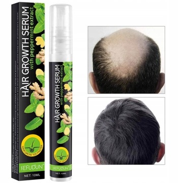 Имбирный спрей для волос с имбирем для мужчин и женщин