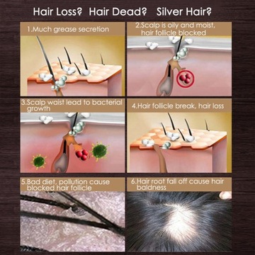 20 мл эссенционное масло для роста волос, женьшень, питание кожи головы