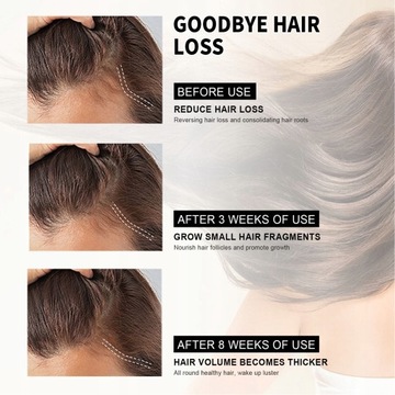 60 МЛ МАСЛО РОЗМАРИНА ДЛЯ ЛЕЧЕНИЯ РОСТА ВОЛОС