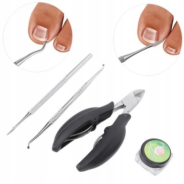 ПРОФЕССИОНАЛЬНЫЕ ЗАЖИМЫ ДЛЯ ВРАСТЫВАЮЩИХ НОГТЕЙ