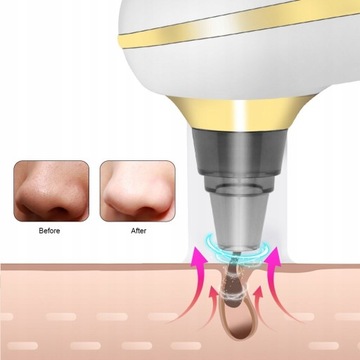 USB-устройство для удаления черных точек для лица, глубокий вакуум