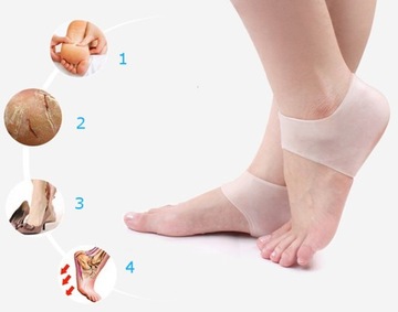 ГЕЛЕВЫЕ ПОКРЫТИЯ ПРИ ТРЕЩИНАХ ПЯТОК, ТРАВМАХ, БЛИКЕРАХ