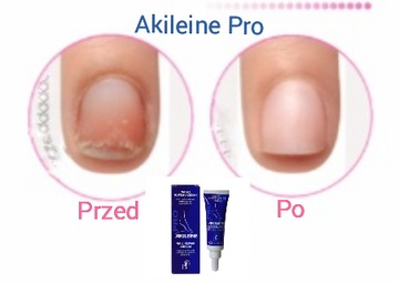 AKILEINE PRO крем Онихолиз для регенерации и реконструкции ногтей 10 мл