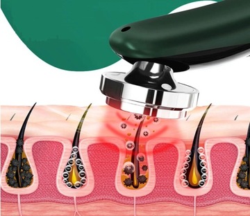 Массажер для лица EMS RADIOTHERAPY (E068)