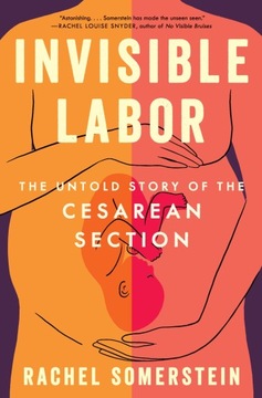 Invisible Labor: The Untold Story of the Cesarean Section Somerstein,