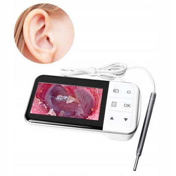 Цифровой отоскоп Визуальный удобный ушной вкладыш