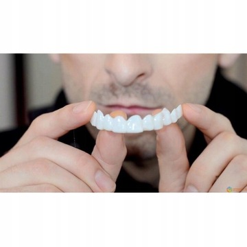 Новейшая привязка к Smile Dental, верхние нижние накладные зубы