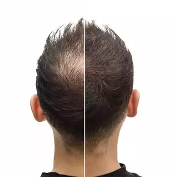 Микроволокна Густые волосы за 30 секунд Маскируют облысение.