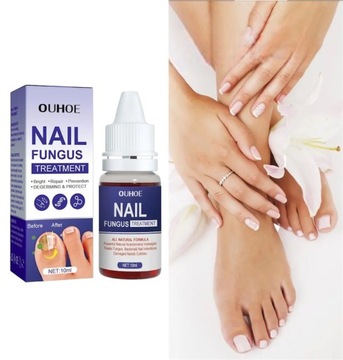 Грибок ногтей Strong Nail Repair Liquid