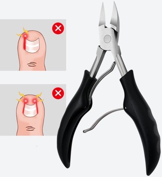 НАБОР КЛИПЕЦОВ ДЛЯ ВРАСТАЮЩИХ НОГТЕЙ 7 В 1