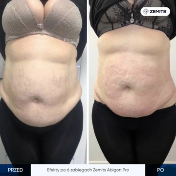 Кавитационный аппарат Zemits Abigon Pro