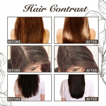 3 шт 100 мл Масло для роста волос Уменьшает шероховатость 8J.