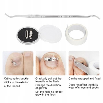 ЗАЖИМЫ ДЛЯ ВРАСТАЮЩИХ НОГТЕЙ КОНСИЛЕР