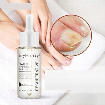 2 × Сильная жидкость для восстановления ногтей от грибка ногтей