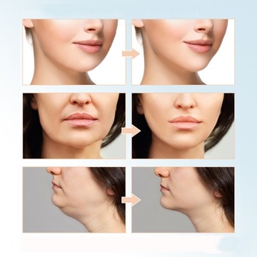 МАССАЖЕР ДЛЯ ЛИЦА ПОДБОРОДОК ЛИФТИНГ СВЕТОДИОДНАЯ ТЕРАПИЯ 2в1