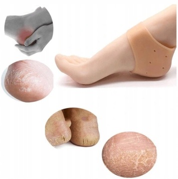 ПОКРЫТИЯ НА ПЯТКИ ГЕЛЕВОЕ ПОКРЫТИЕ ОТ ТРЕСКОВАННЫХ ПЯТОК БОЛИ ПЕНИЕ ТРЕЩИНЫ СУХОЙ ПАР