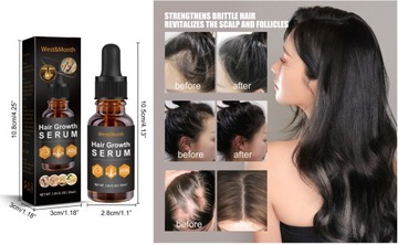 West&Month Сыворотка для роста волос для чернокожих женщин, Сыворотка для роста волос, против волос