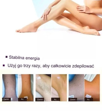 Nd Yag Laser 4in1 IQPRO Удаление волос с татуировкой Электролиз OPT IPL